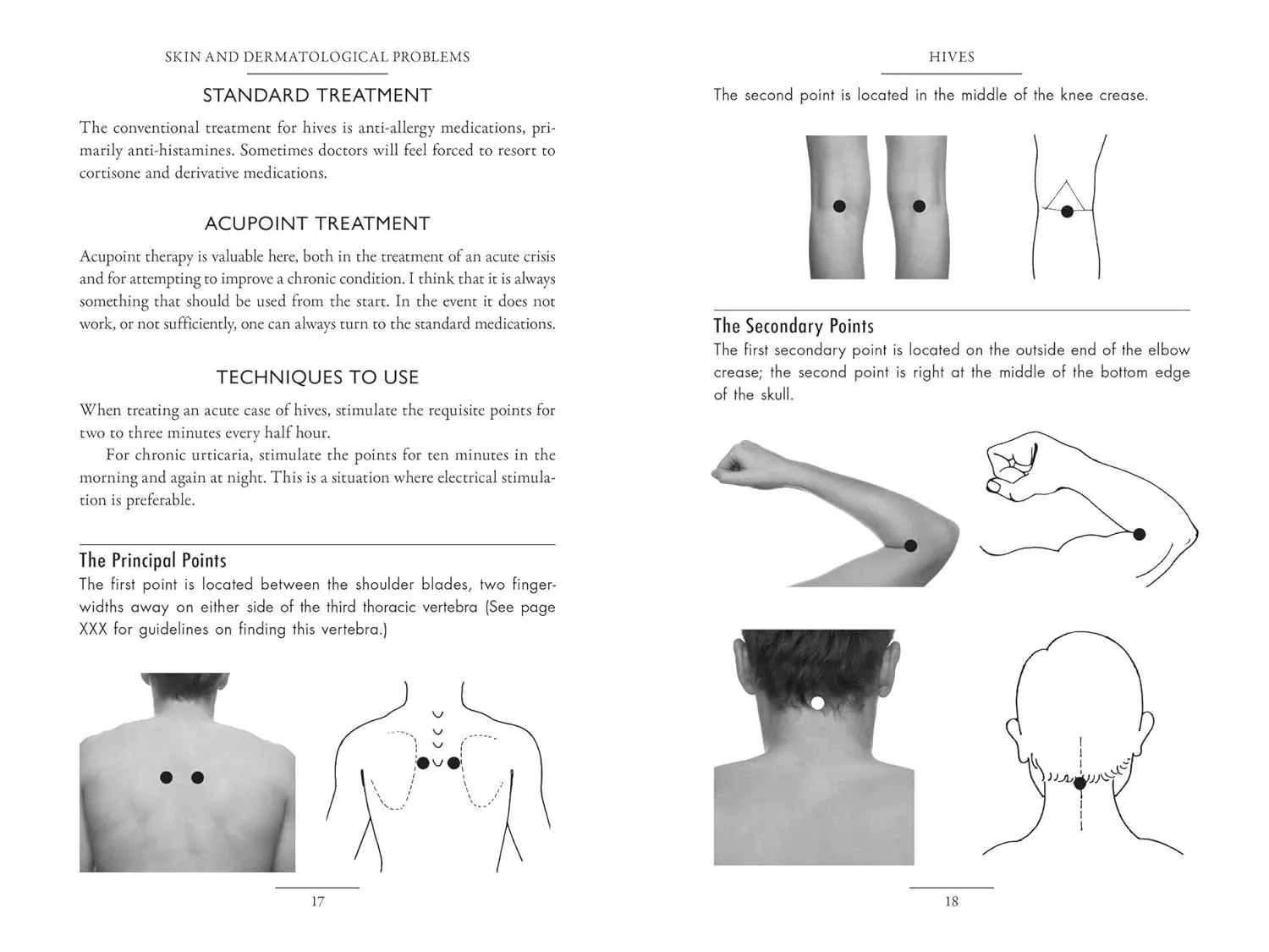 Acupressure Self-Care Handbook: Healing at Your Fingertips
