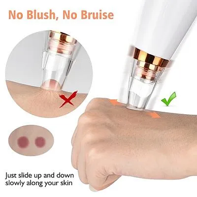 Blackhead Remover Pore Vacuum, Facial Pore Cleaner