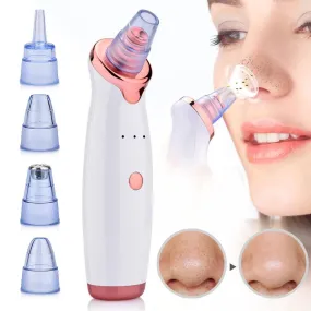 Blackhead Vacuum Facial Pore Cleaner (USB Rechargeable)