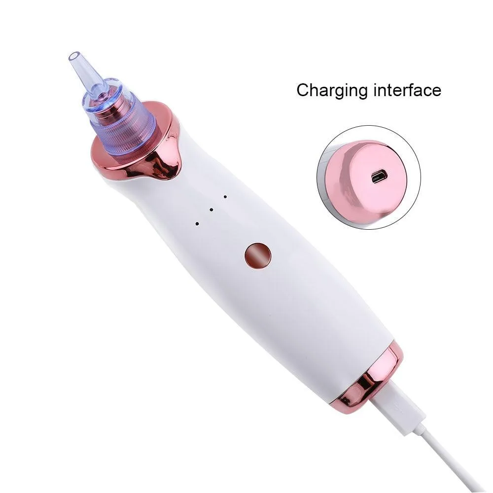 Blackhead Vacuum Facial Pore Cleaner (USB Rechargeable)