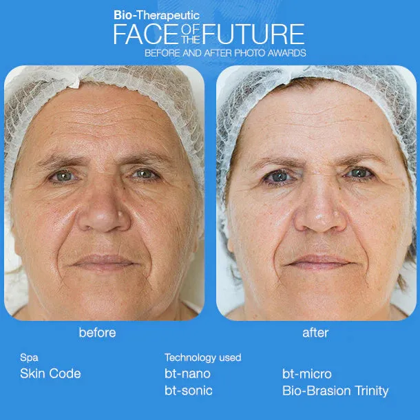 BT Sonic 2.0 Facial Cleansing