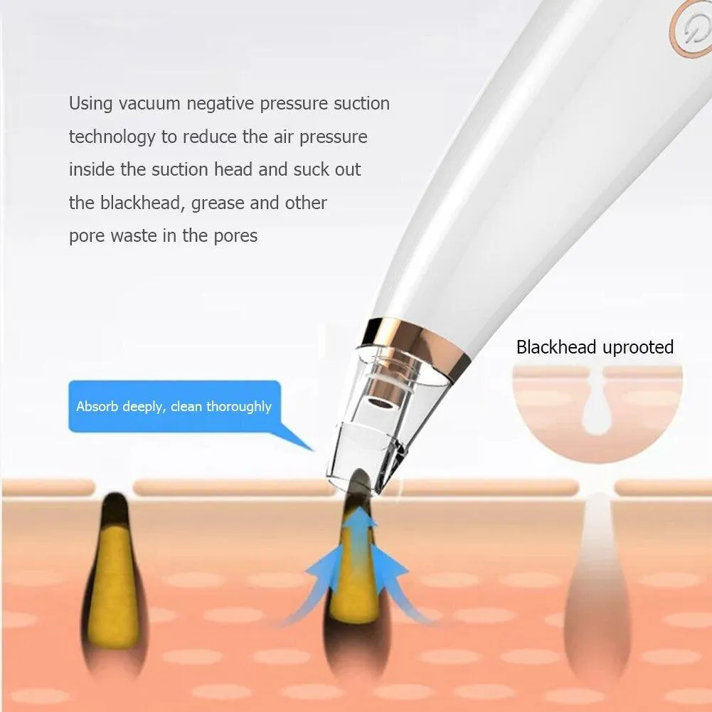 Electric Vacuum Facial Blackhead Remover -F19-8-35
