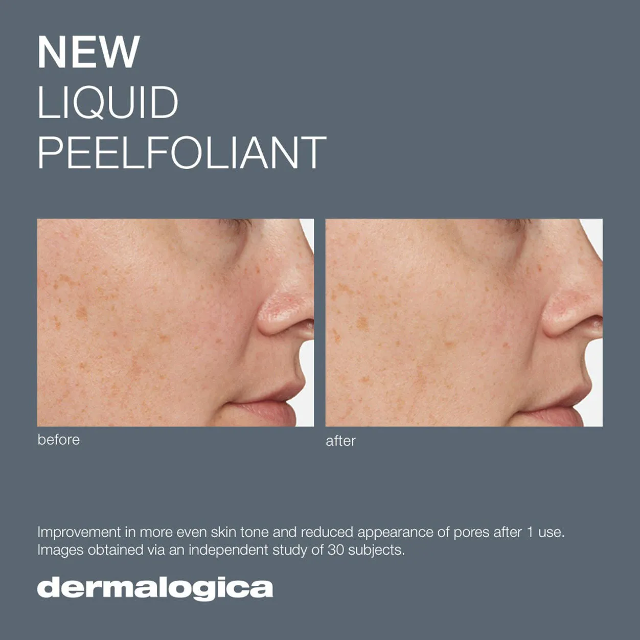 Liquid Peelfoliant