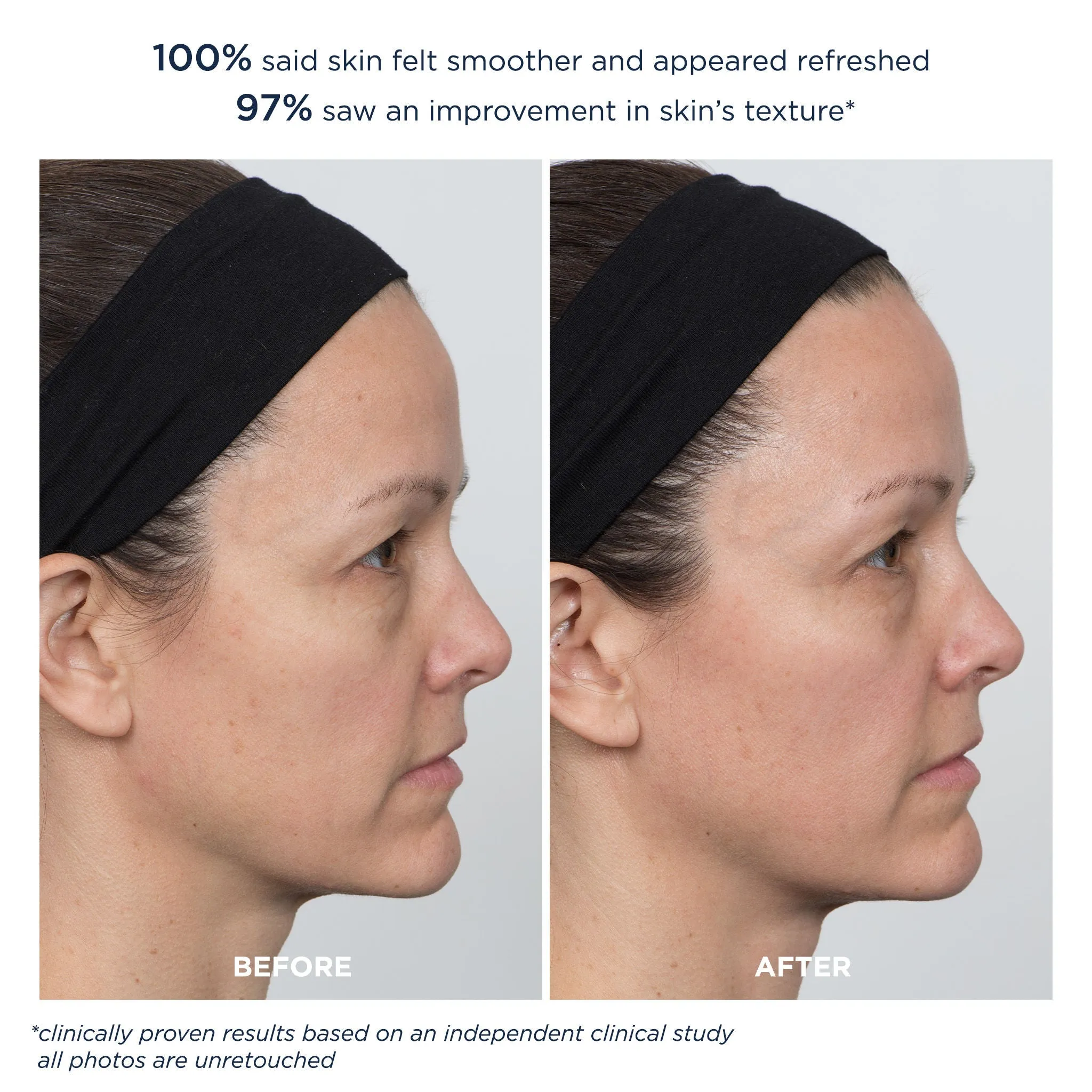 PowerGlow Peel Extra Strength 20%