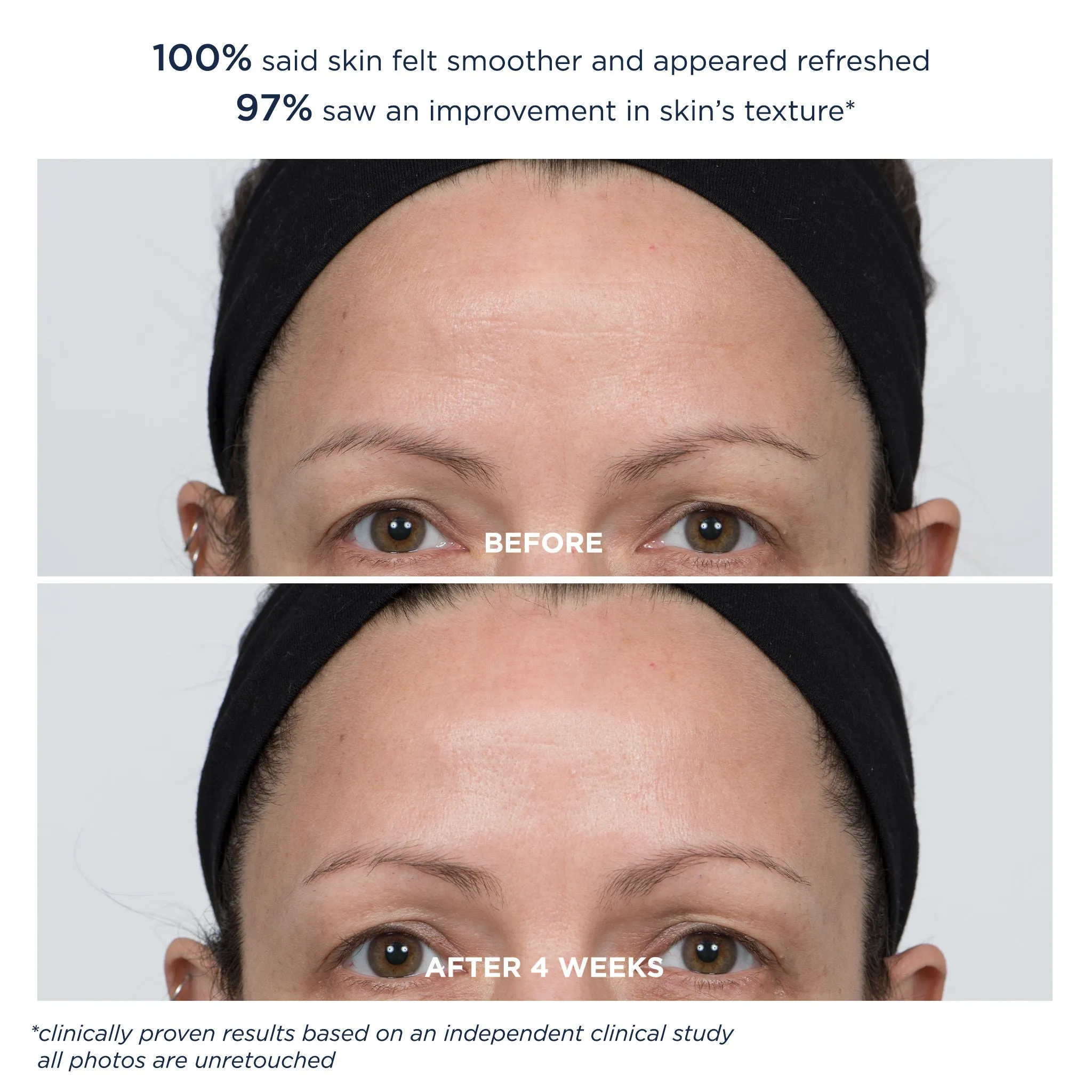 PowerGlow Peel Extra Strength 20%