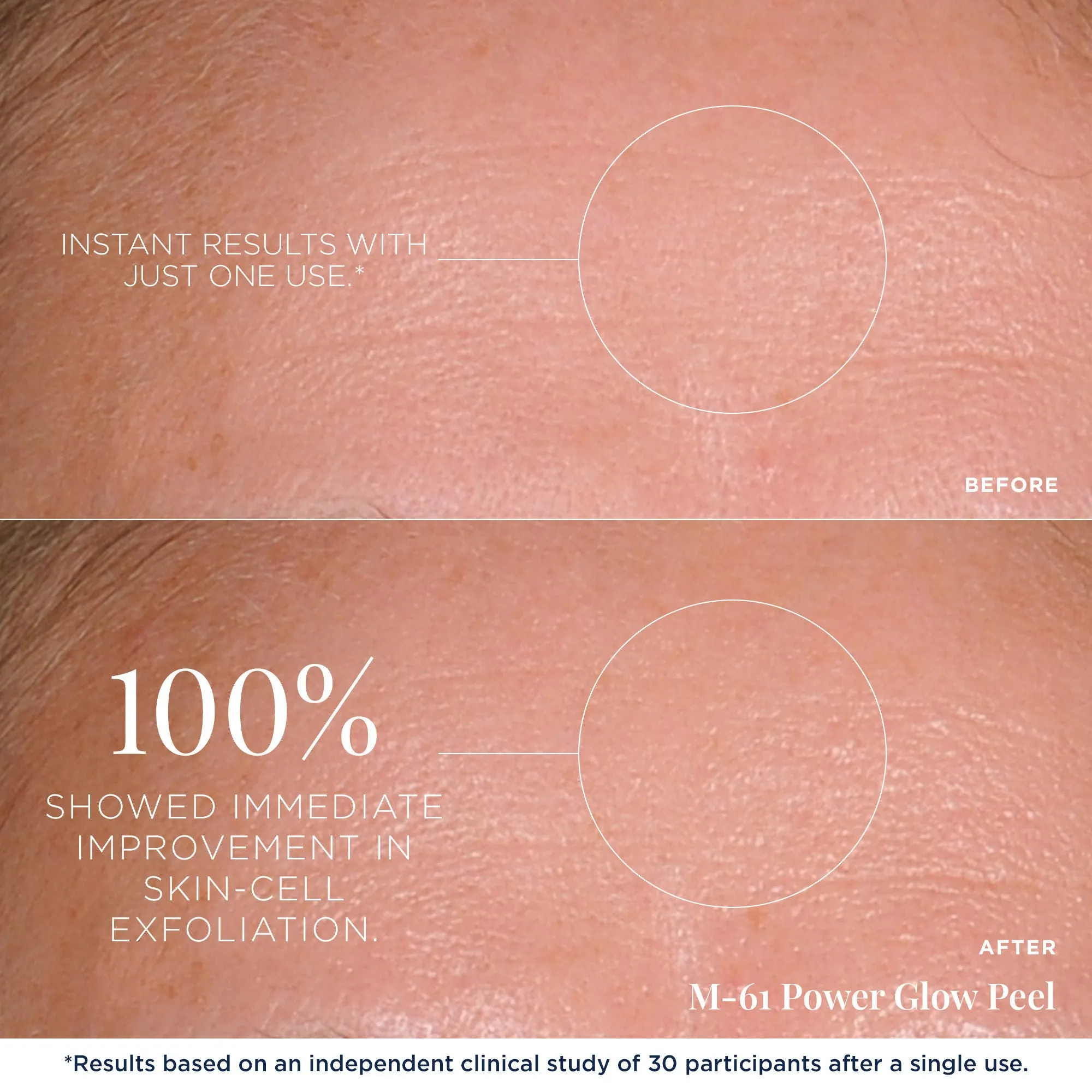 PowerGlow Peel
