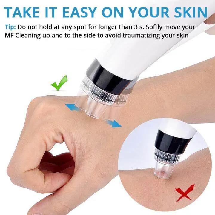 Vacuum Pore Cleanser