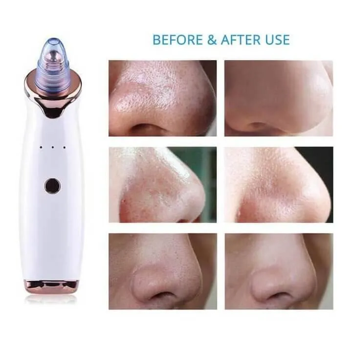 Vacuum Pore Cleanser